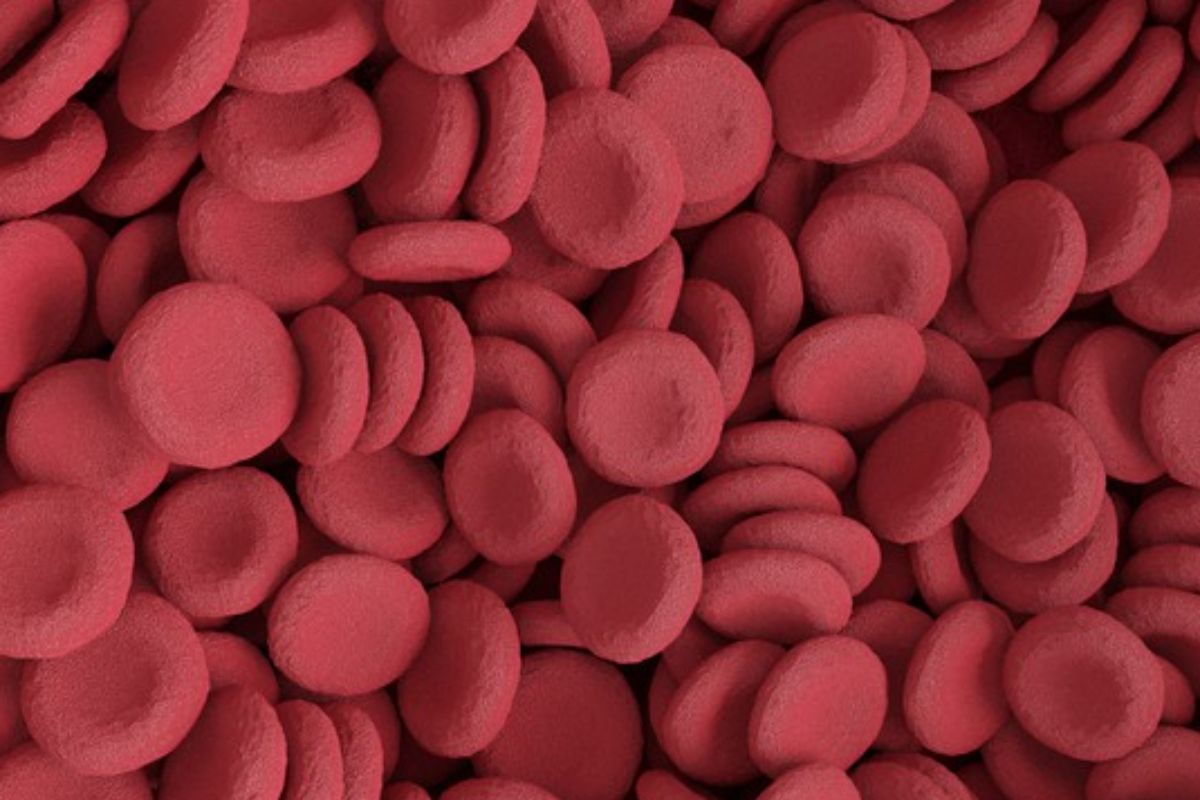 La anemia de célula falciforme es una anemia hemoltica congénita causada por una alteración de la secuencia del gen que codifica la sntesis de cadenas beta de la globina.