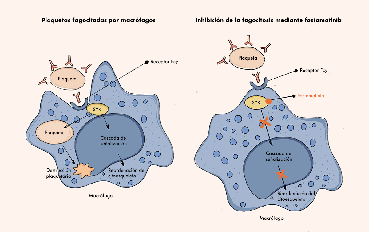 Plaquetas fagocitadas por macrófagos