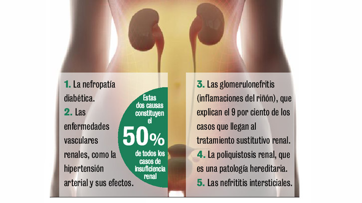 Insuficiencia renal grado 2