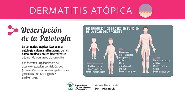 Dermatitis de contacto en manos y pies